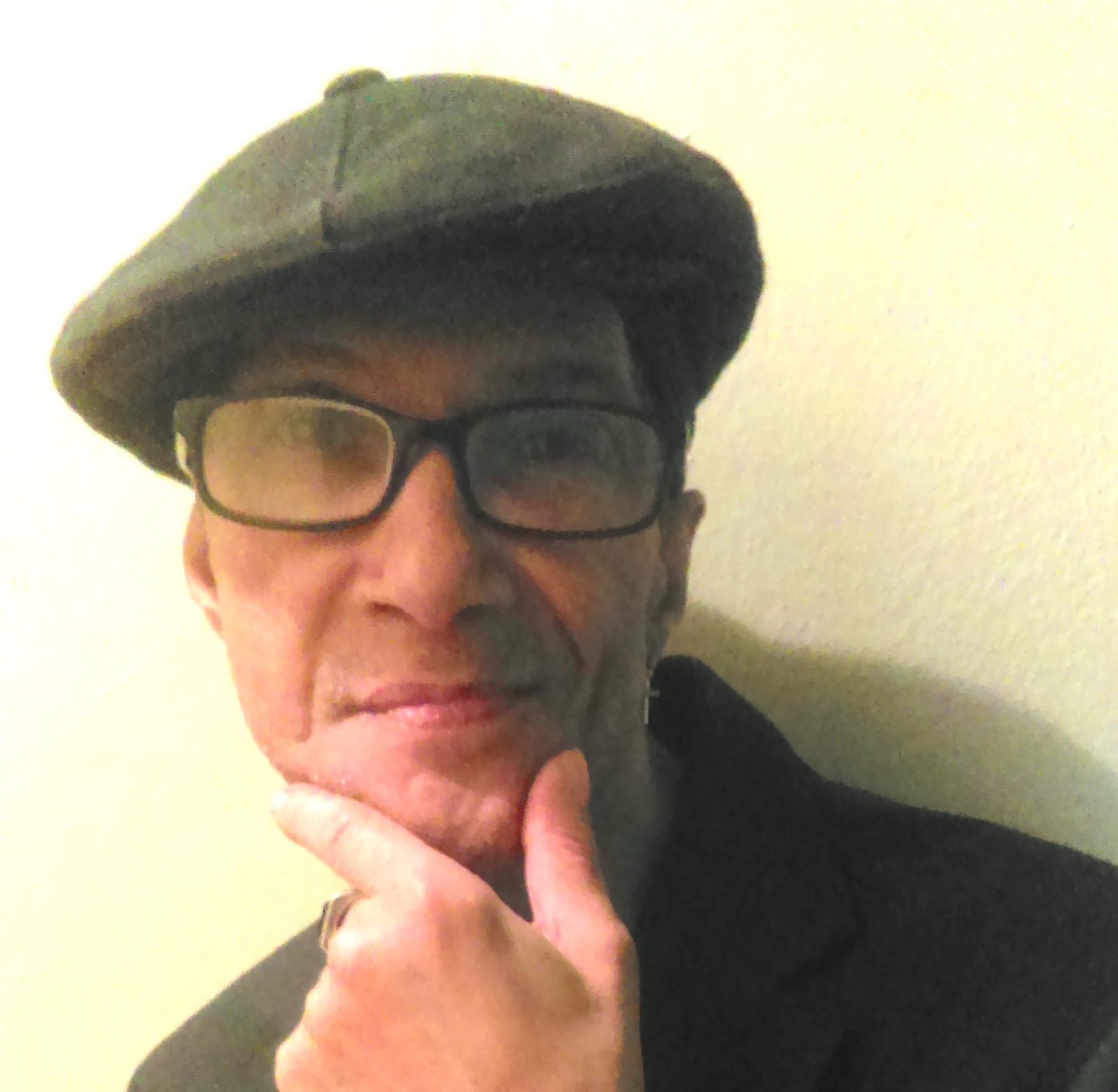 On World AIDS Day, remembering my brother Harry 2 Dennis Levy.