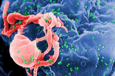 HIV Newborn Treatment